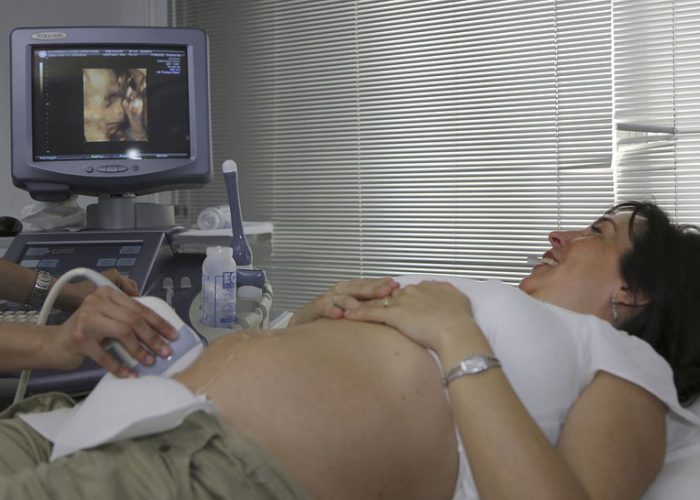 Ultrasound